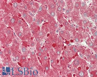 CPT1A Antibody (aa191-353)