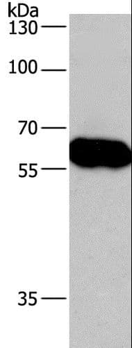 Polyclonal Rabbit anti-Human CORO1C Antibody (IHC, WB)
