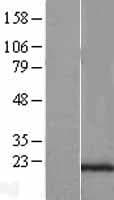SEC11C Protein (Over-Expression Lysate Myc-DDK (Flag))