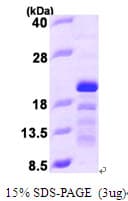 Human SCLIP / STMN3 Protein (Recombinant His)