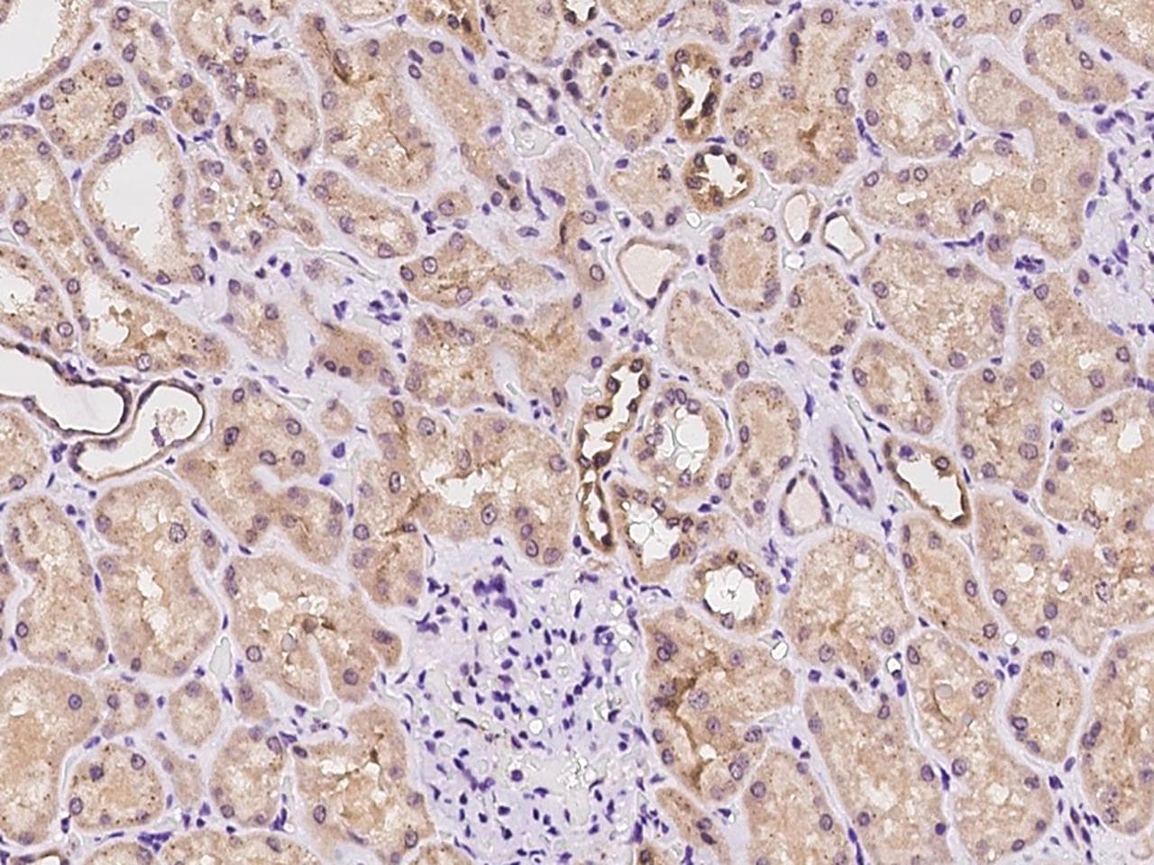 CHMP4C Antibody