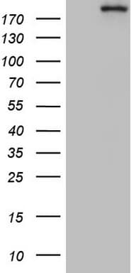 Monoclonal Mouse anti-Human TOP2A / Topoisomerase II Alpha Antibody (clone OTI1D4, aa1100-1531, WB)