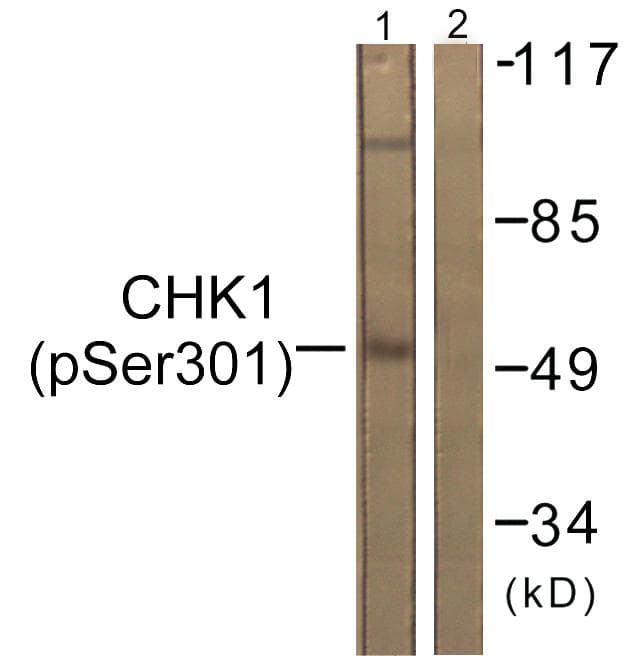 CHEK1 / CHK1 Antibody (phospho-Ser301)