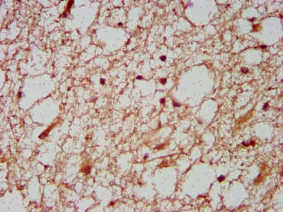 HOXD1 Antibody
