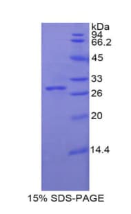 Rat GLB1 / Beta-Galactosidase Protein (Recombinant His)