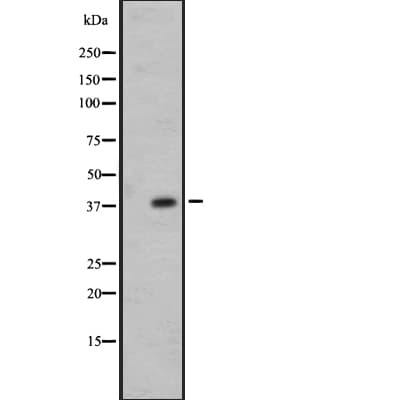 Polyclonal Rabbit anti-Human OR7E24 Antibody (IHC, WB)