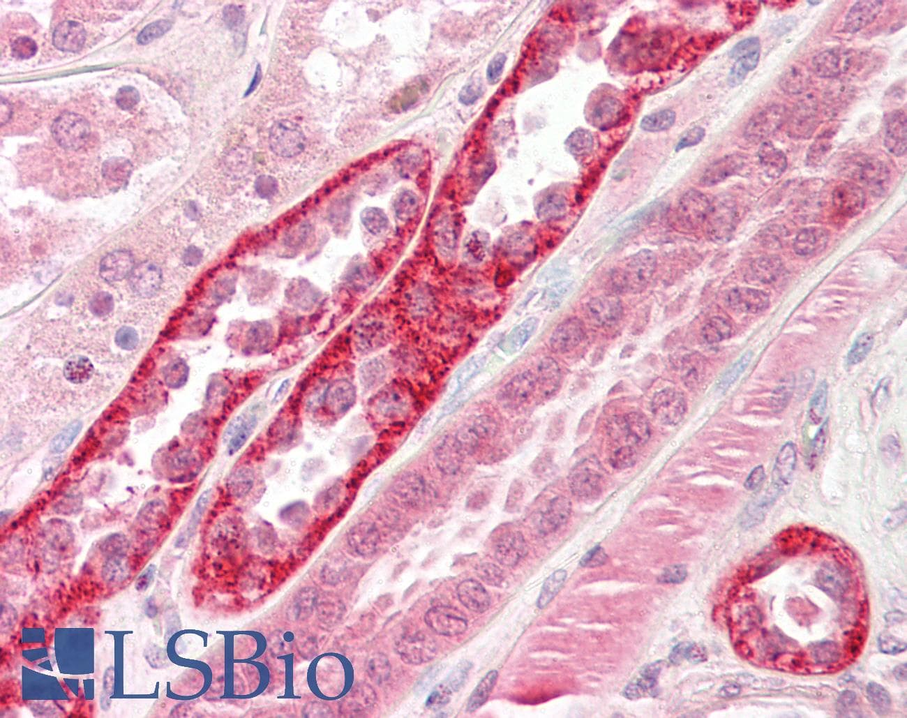 IHC-plus™ CSNK2A1 Antibody