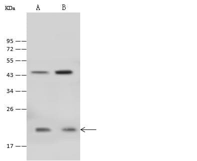 CARHSP1 Antibody (Preservative Free)