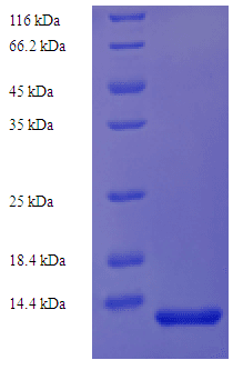 Human CD81 Protein (Recombinant His)