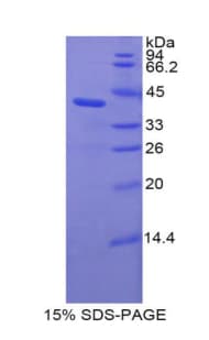 Rat Complement C3a Protein (Recombinant His)