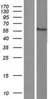 CYP17 / CYP17A1 Protein (Over-Expression Lysate Myc-DDK (Flag))