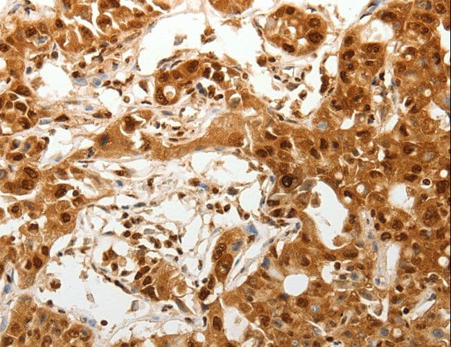 ODZ3 Antibody