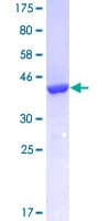 Human FABP3 / H-FABP Protein (Recombinant GST)