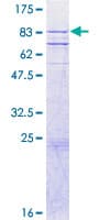 Human CASP10 / Caspase 10 Protein (Recombinant GST)