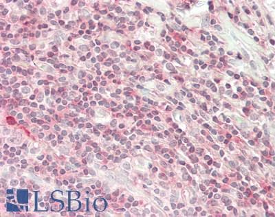 IHC-plus™ Polyclonal Rabbit anti-Human SOD1 / Cu-Zn SOD Antibody (aa 2-154, IHC, IF, WB)