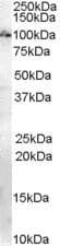 Anillin Antibody (aa1018-1028)