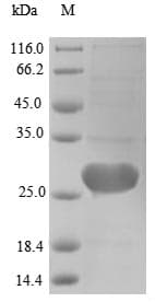 Human MGMT Protein (Recombinant 6His, N-terminus)