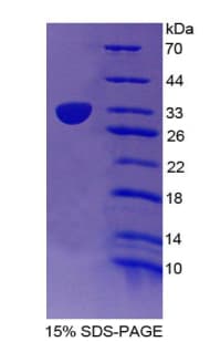 Mouse TBX21 / T-bet Protein (Recombinant His-T7)