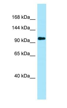 PKP4 / Plakophilin 4 Antibody (N-Terminus)