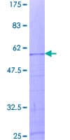 Human HIST1H1A Protein (Recombinant GST)