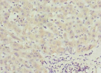 CALCOCO1 / CoCoa Antibody