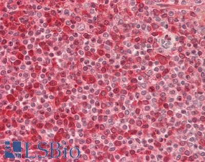 IHC-plus™ KIAA0391 Antibody