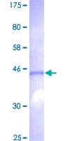 Human KRTAP13-1 Protein (Recombinant GST)