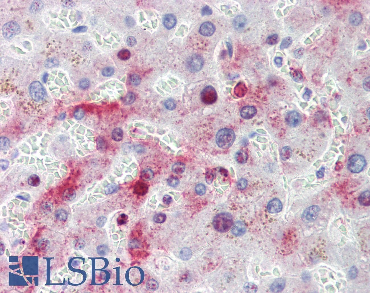 IHC-plus™ MTHFD1 Antibody (aa137-150)
