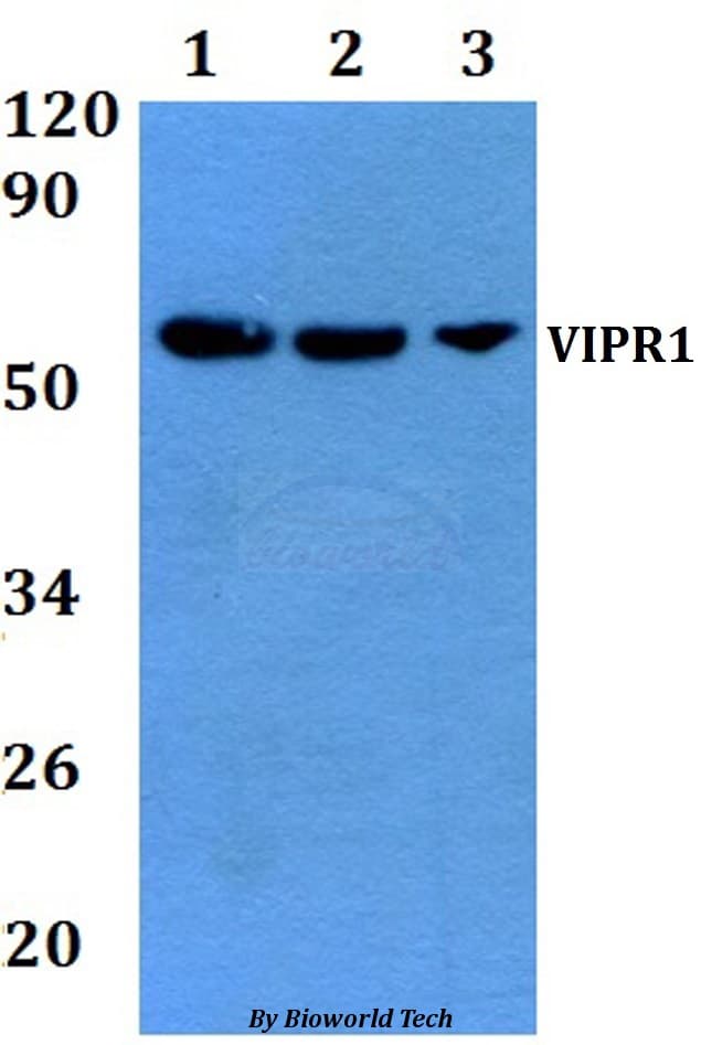Polyclonal Rabbit anti-Human VIPR1 Antibody (WB)