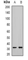 EBAG9 / RCAS1 Antibody