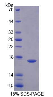 Human GABARAPL2 / ATG8 Protein (Recombinant His-T7)