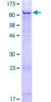 Human TTC6 Protein (Recombinant GST)