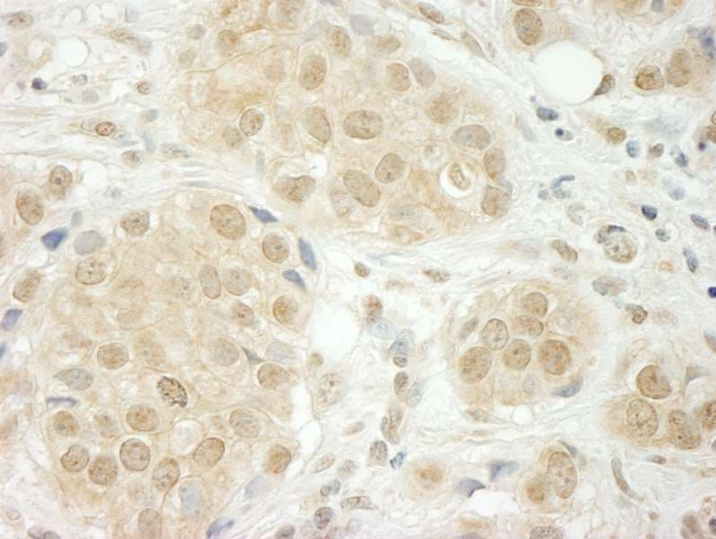 THOC5 Antibody (aa25-75)