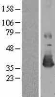 MSRA Protein (Over-Expression Lysate Myc-DDK (Flag))