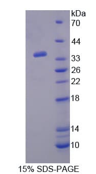 Mouse PON2 Protein (Recombinant His)