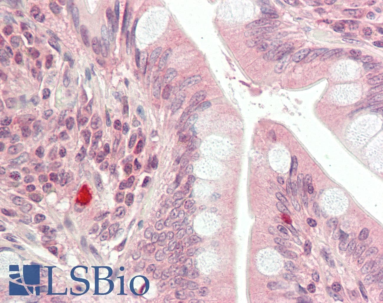IHC-plus™ HDAC9 Antibody (N-Terminus)