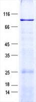 Human EML1 / EMAP Protein (Recombinant His, N-Terminal)