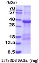 Human HAVCR1 / KIM-1 Protein (Recombinant His)