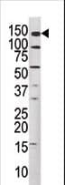 Polyclonal Rabbit anti-Human c-Met Antibody (phospho-Tyr1349, IHC, WB)