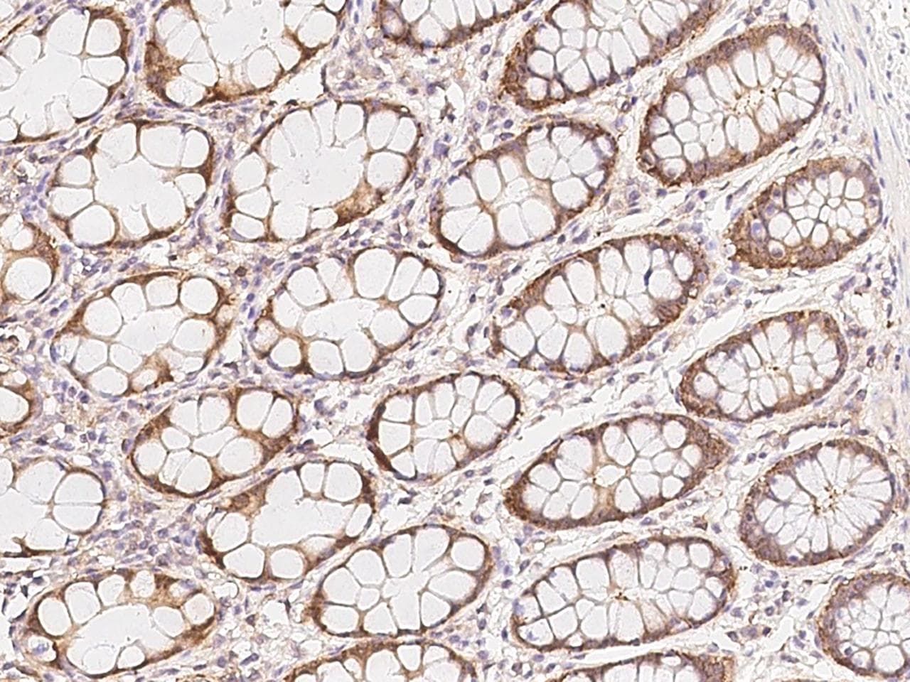 Polyclonal Rabbit anti-Human ZNF720 Antibody (IHC)