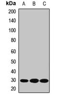 Polyclonal Rabbit anti-Human 15-PGDH / HPGD Antibody (WB)