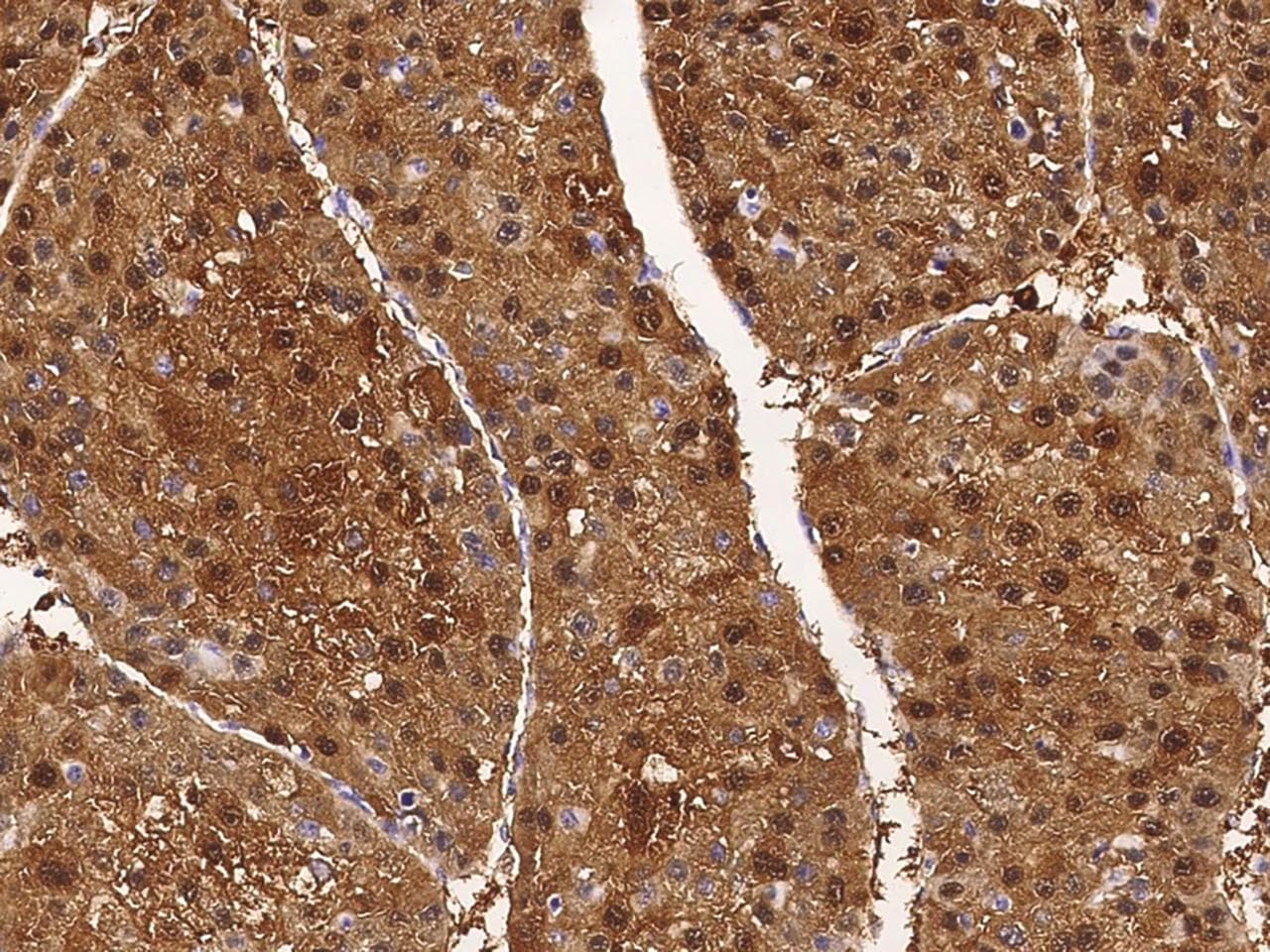Polyclonal Rabbit anti-Human ARG1 / Arginase 1 Antibody (IHC)