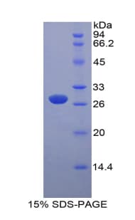 Mouse MYLK Protein (Recombinant His-T7)