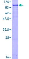 Human XRCC5 / Ku80 Protein (Recombinant GST)