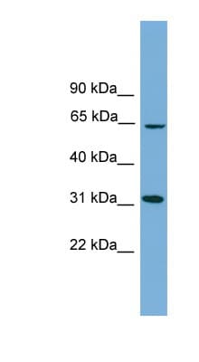 Polyclonal Rabbit anti-Human HSD17B11 Antibody (aa35-84, WB)