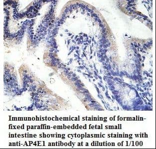 Polyclonal Rabbit anti-Human AP4E1 / Adaptin Epsilon Antibody (aa951-1136, IHC, WB)