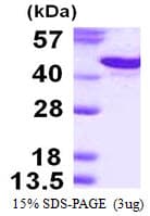 Human SDC1 / Syndecan 1 / CD138 Protein (Recombinant His)