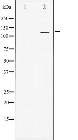SREBF1 / SREBP-1 Antibody