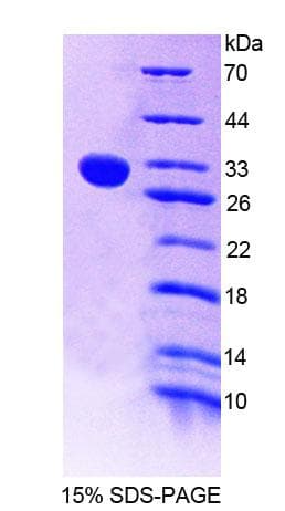 Mouse CHIT1 / Chitotriosidase Protein (Recombinant His-T7)