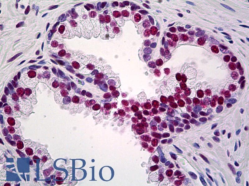 IHC-plus™ Monoclonal Mouse anti-Human TRIM28 / KAP1 Antibody (clone 1D11, IHC, WB)